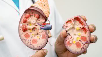 Showing kidneys, ESRD