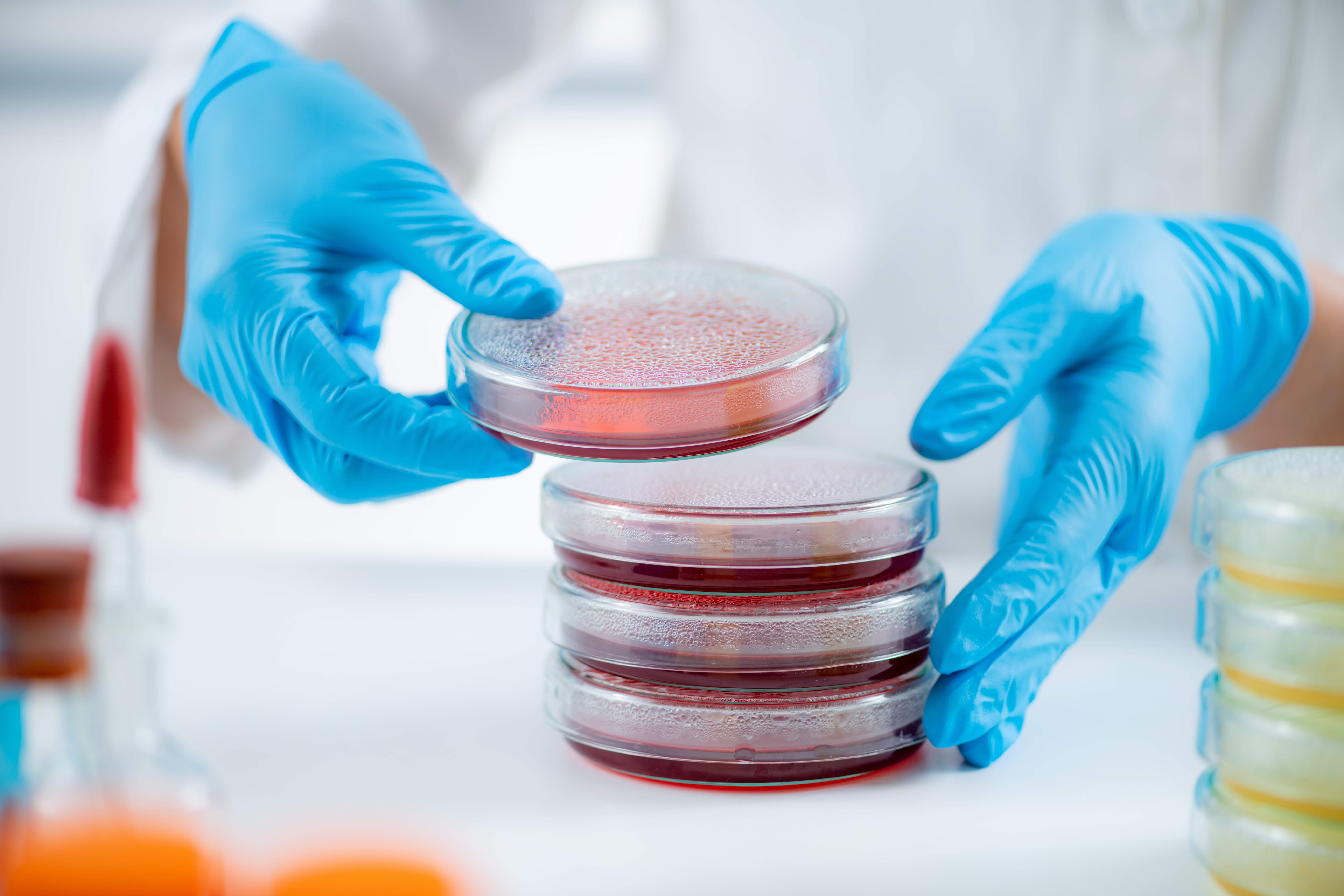Lab worker with bacteria specimen
